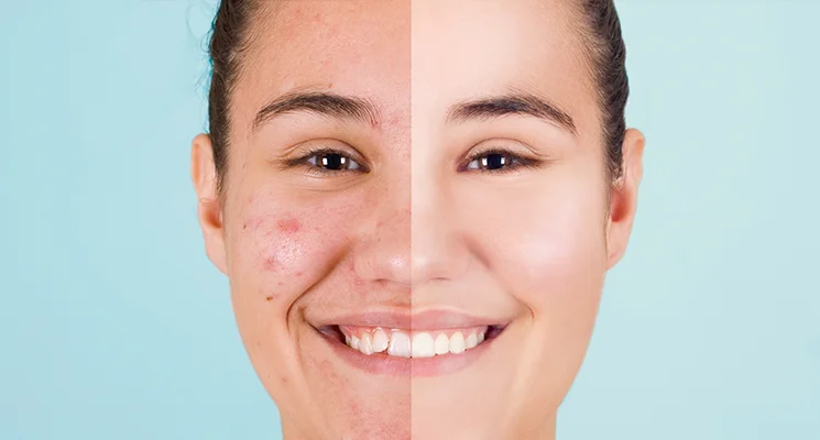 rutina facial en pamplona